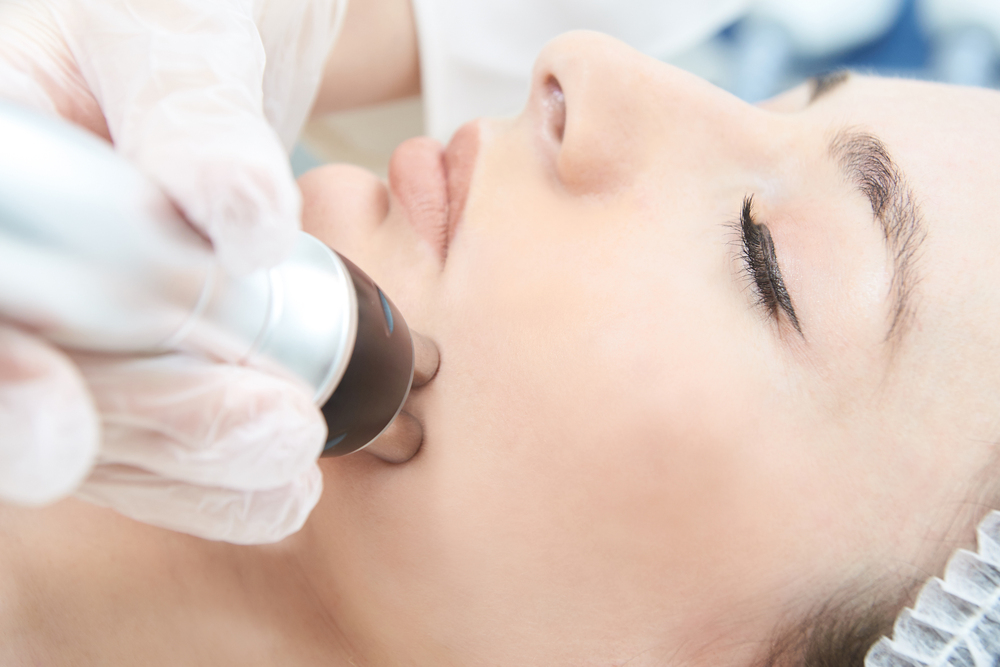 Combining Laser Skin Resurfacing